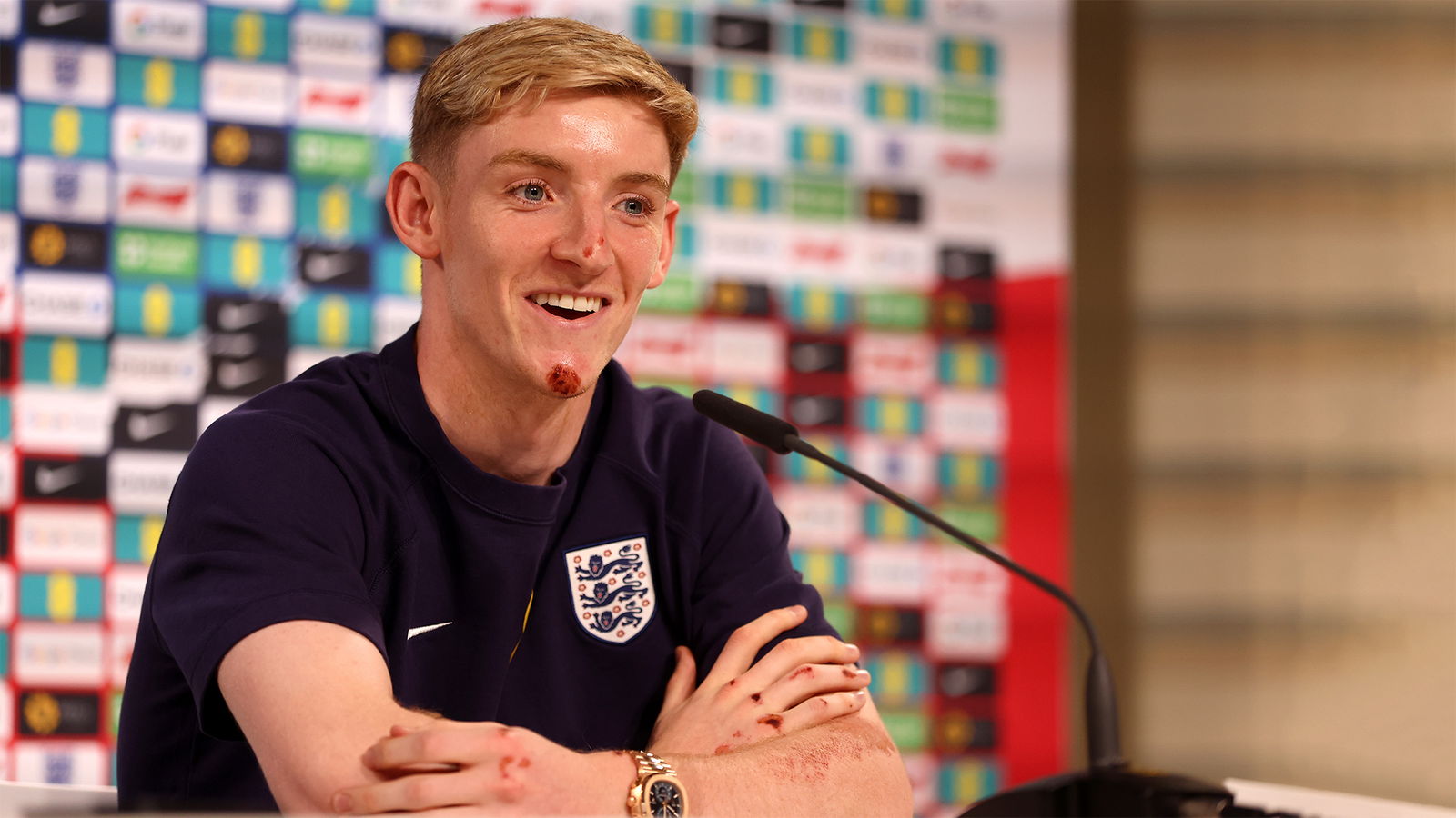 Anthony Gordon put up by England to face the media before Slovakia ...